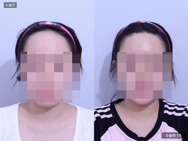 이마거상