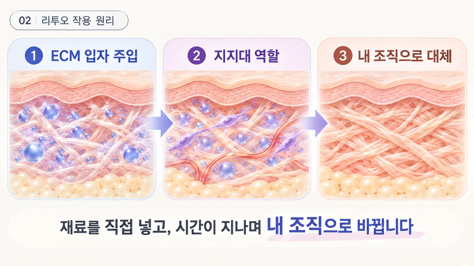 리투오 작용 원리 - 주입한 ECM이 지지대가 되고 그 자리를 내 콜라겐이 채움
