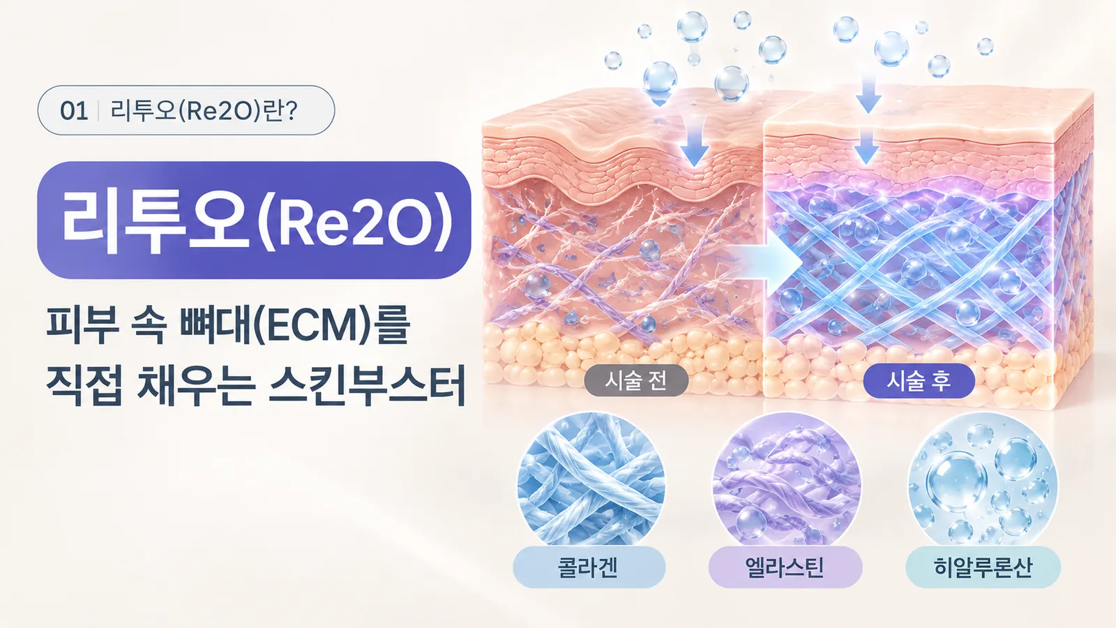 리투오(Re2O)란 - 피부 속 ECM 구조를 직접 채우는 스킨부스터