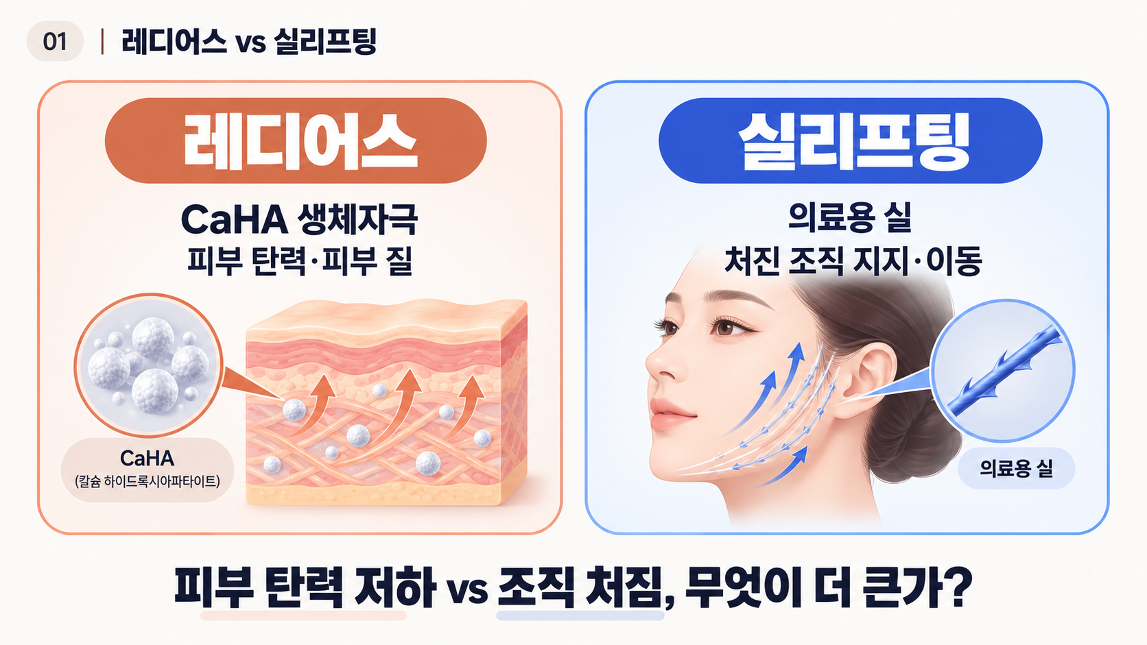 레디어스와 실리프팅 차이 및 얼굴 리프팅 선택 기준