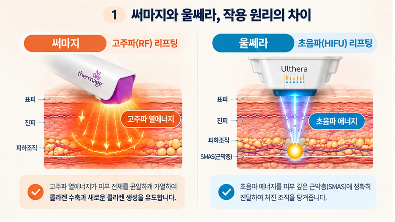 써마지 울쎄라 차이 고주파 초음파 리프팅 에너지 전달 원리 비교