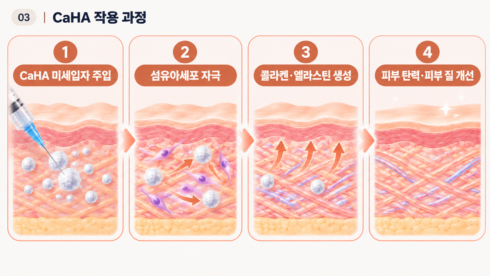 레디어스 CaHA 콜라겐 생성과 피부 탄력 개선 원리