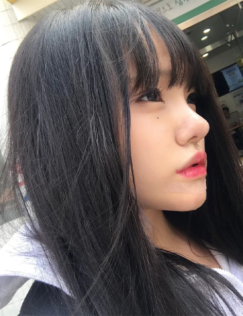 서울아이 맞춤 코성형 리얼 셀피 1