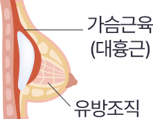 이중평면 듀얼플레인 단면도