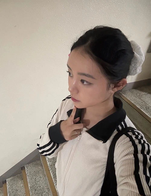 서울아이 맞춤 코성형 리얼 셀피 2