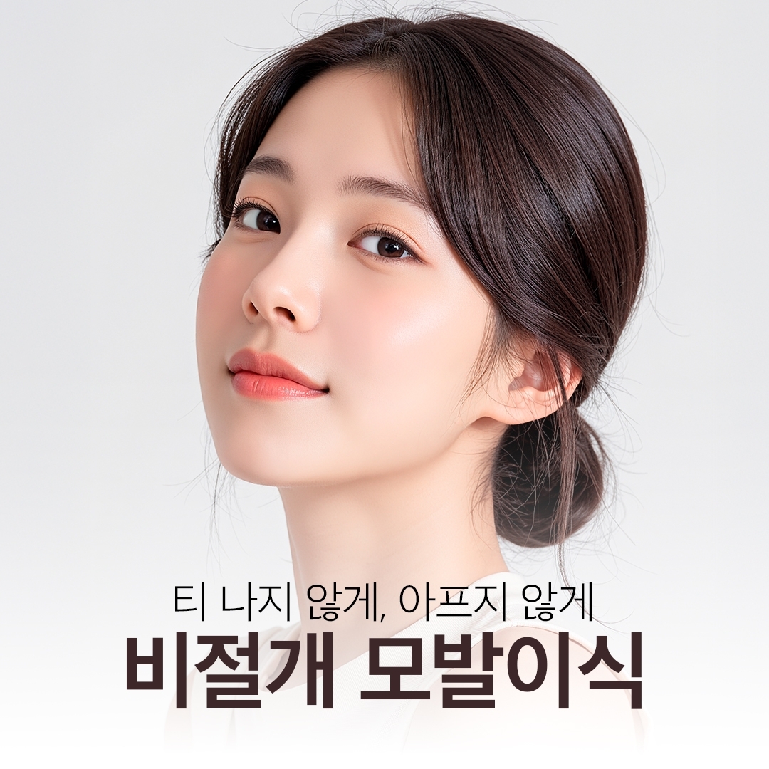 Non-incisional hair transplantation