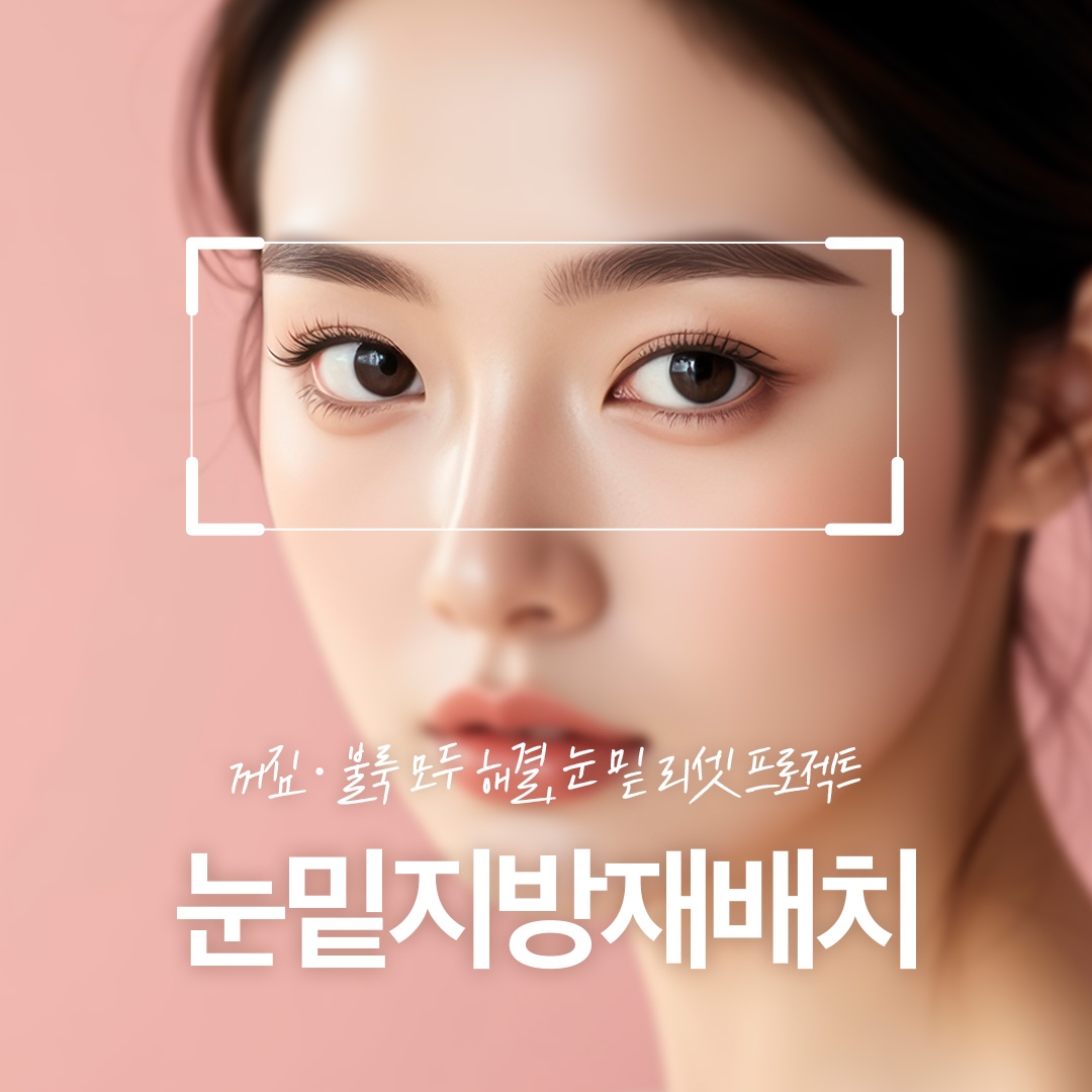 눈밑지방재배치