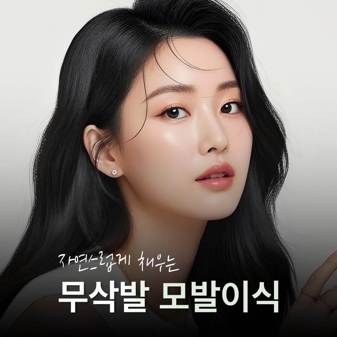 무삭발모발이식