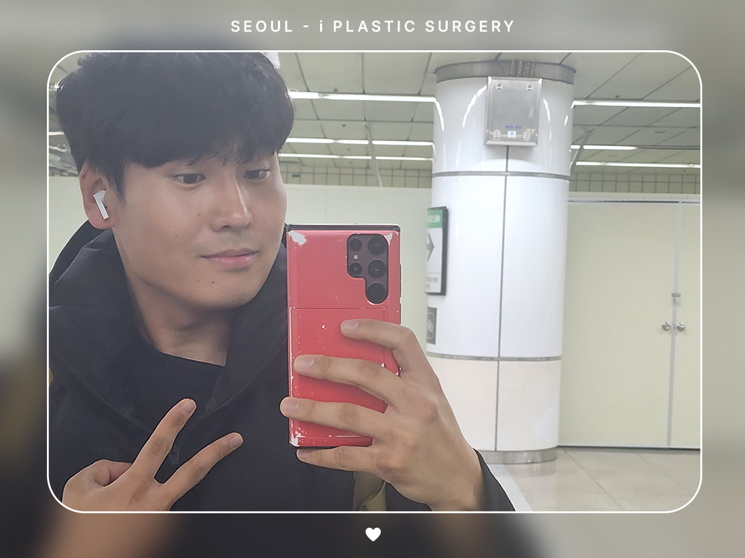 #자연유착 #눈매교정