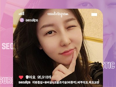 리얼셀카_#지방흡입 #융비술&코끝조각술(비중격) #메부리코 #복코교정