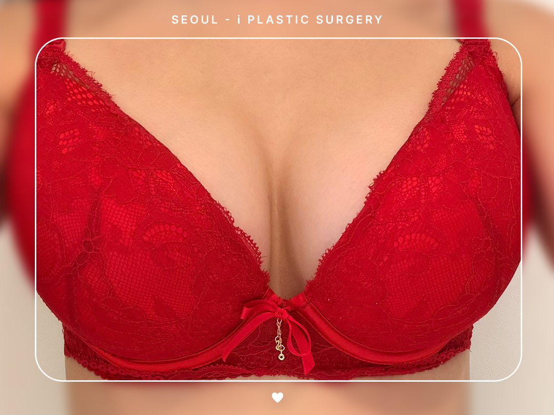 #가슴 #보형물 #내추럴가슴보형물
