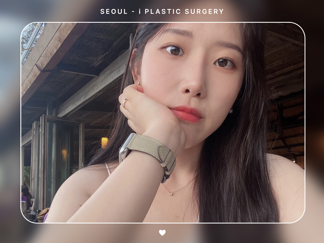 #미용코 #복코 #매부리코교정