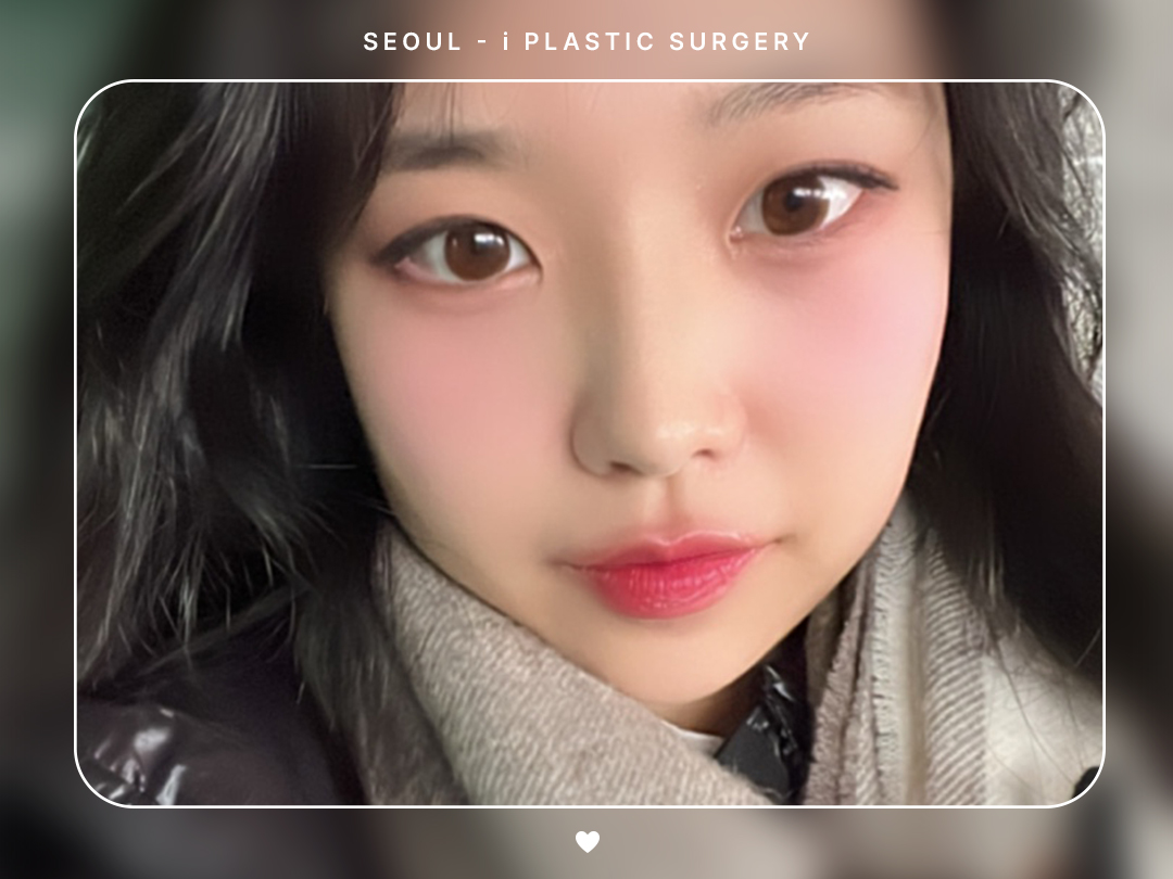 #미용코 #복코 #매부리코교정