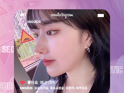 리얼셀카_#코끝조각술 #복코교정술 #비중격 #메부리코