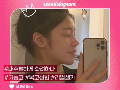 리얼셀카_#기능코성형 #복코교정술 #코끝 #매부리코