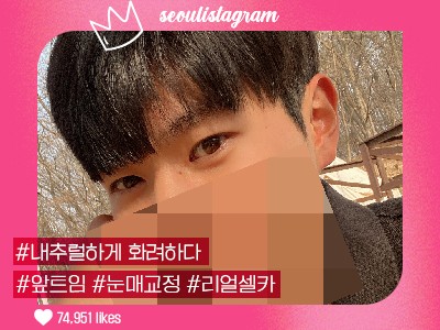 #앞트임 #자연유착 #눈매교정
