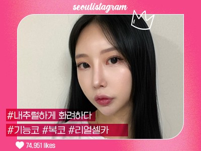 리얼셀카_#기능코성형 #융비술&코끝조각술 #복코 #매부리교정