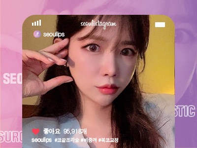 리얼셀카_#코끝조각술 #비중격 #복코교정