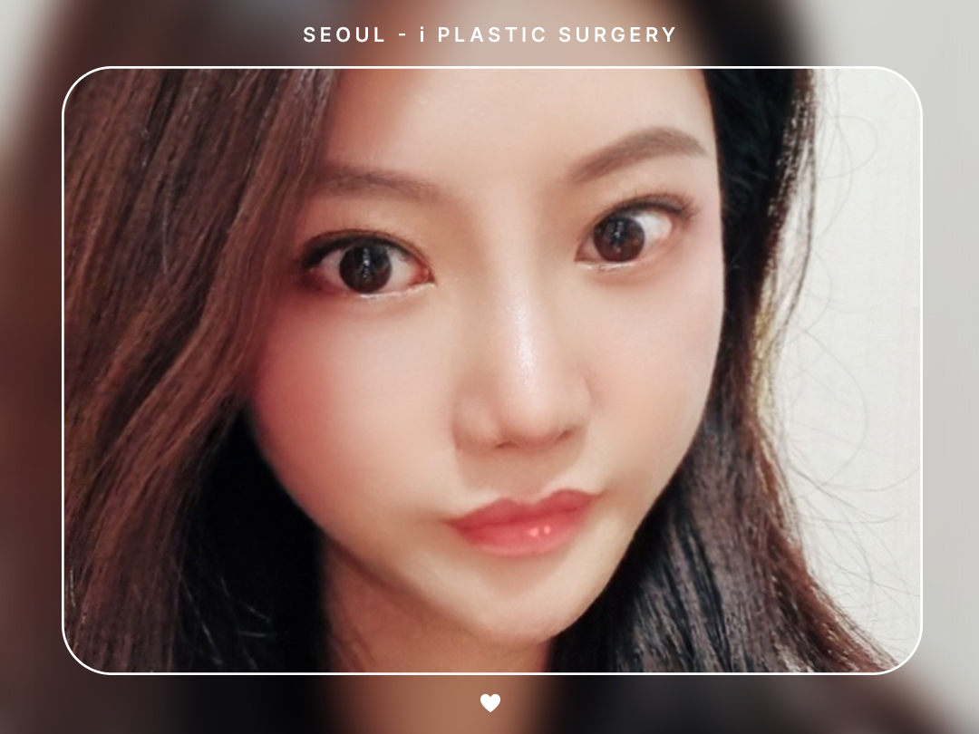 #리프팅 #실리프팅