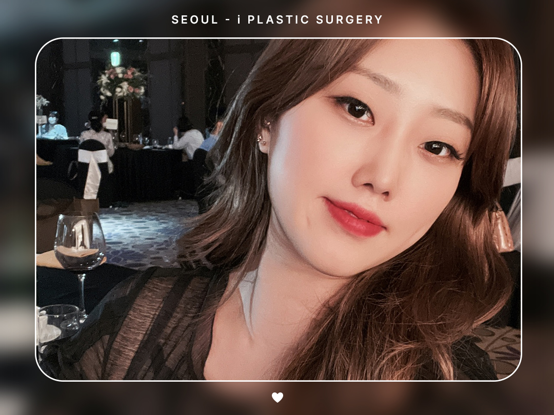 #미용코 #콧대 #짧은코교정
