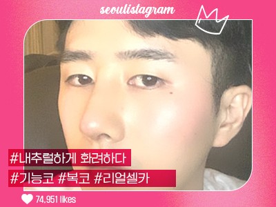 |리얼셀카_#기능코성형 #짧은코 #복코 #매부리교정