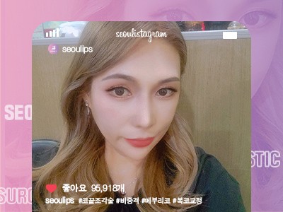 리얼셀카_#코끝조각술 #비중격 #메부리 #복코