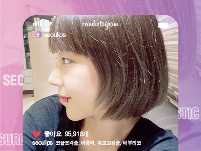 리얼셀카_#코끝조각술 #비중격 #복코교정술 #메부리코