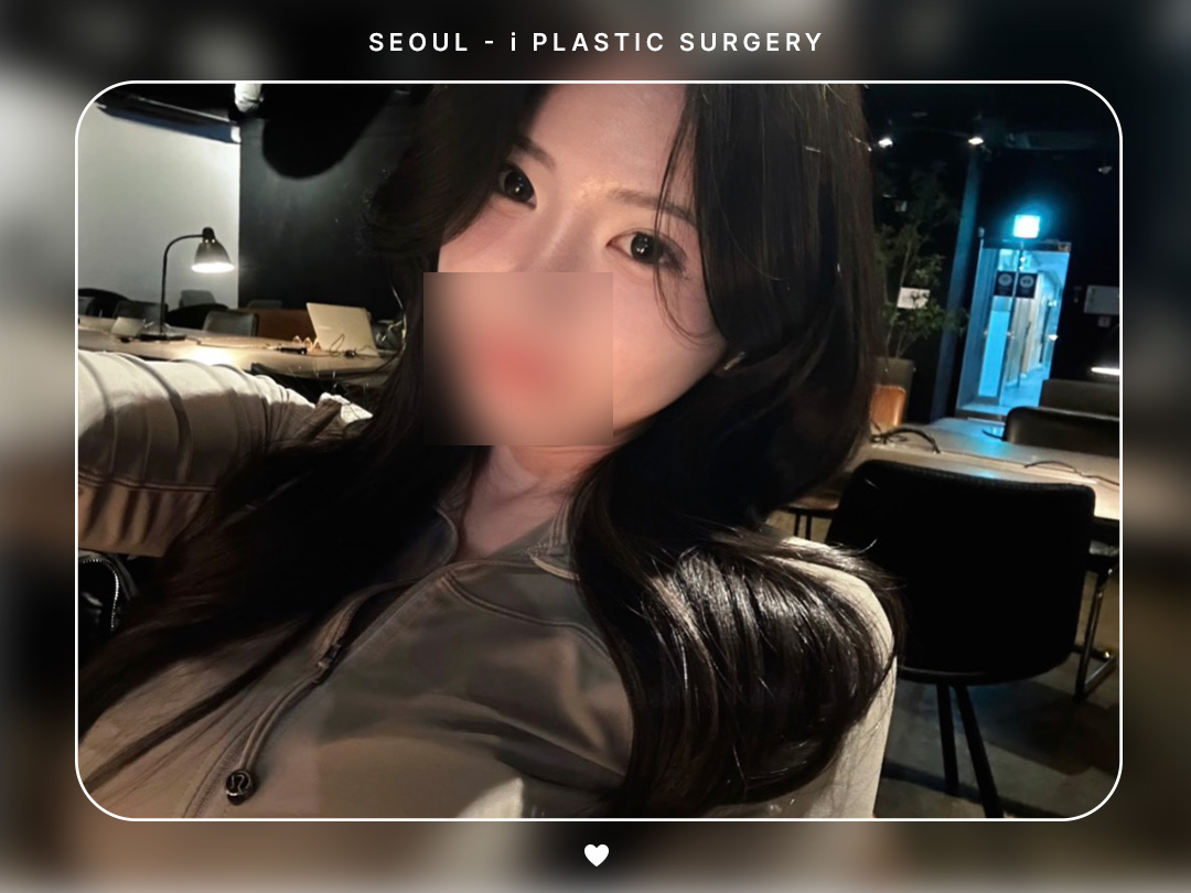 #자연유착 #뒷트임