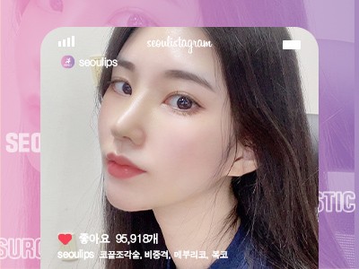 리얼셀카_#코끝조각술 #비중격 #메부리코 #복코
