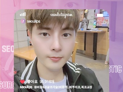 리얼셀카_#융비술&코끝조각술(비중격) #복코교정술 #메부리코