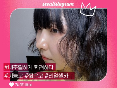 #짧은코교정 #복코교정 #매부리교정