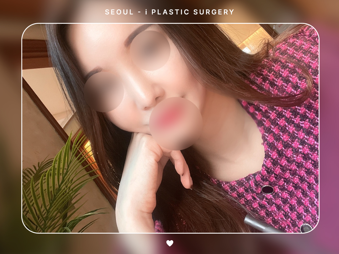 #미용코 #코끝 #복코교정