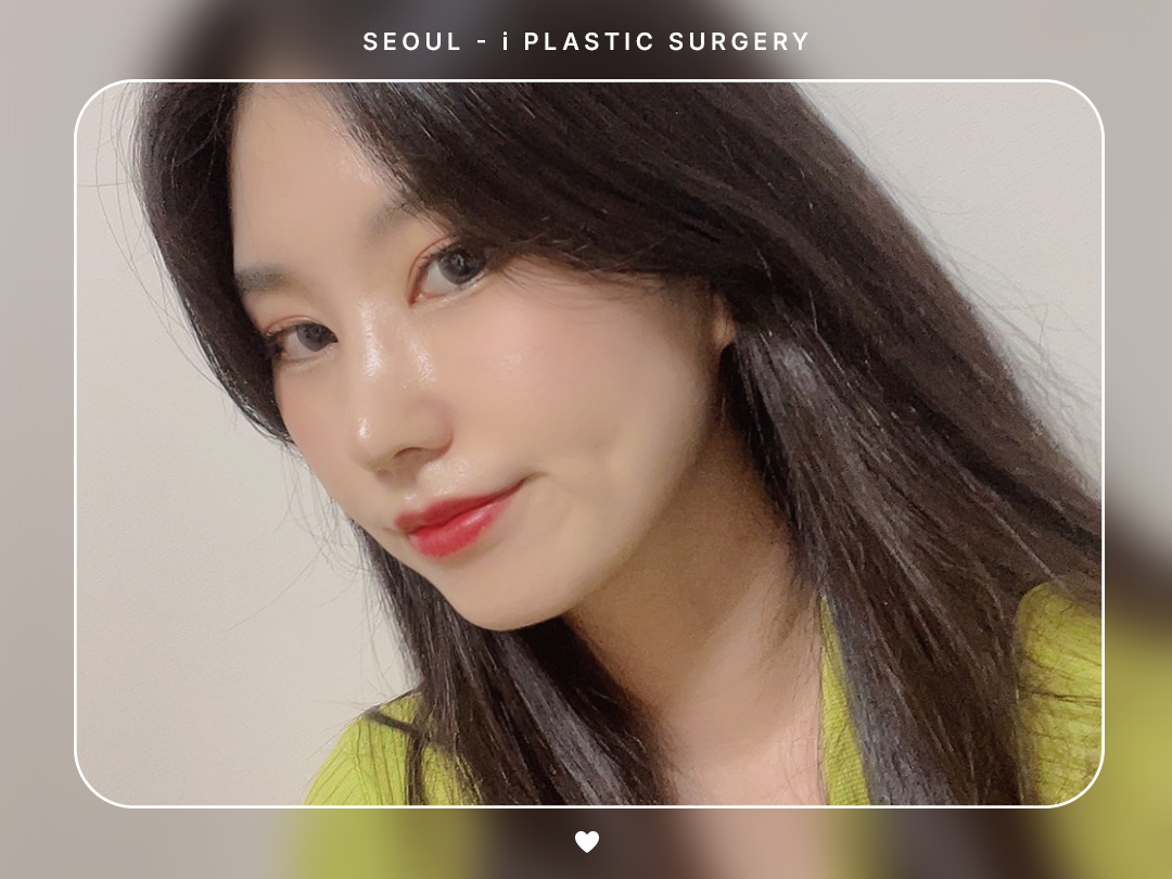 #미용코 #코끝 #매부리코교정
