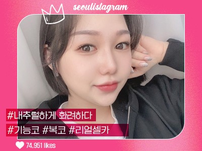 리얼셀카_#기능코성형 #융비술&코끝조각술(비중격) #복코 #매부리교정