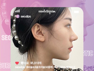 리얼셀카_#융비술&코끝조각술(비중격) #복코교정술 #메부리코