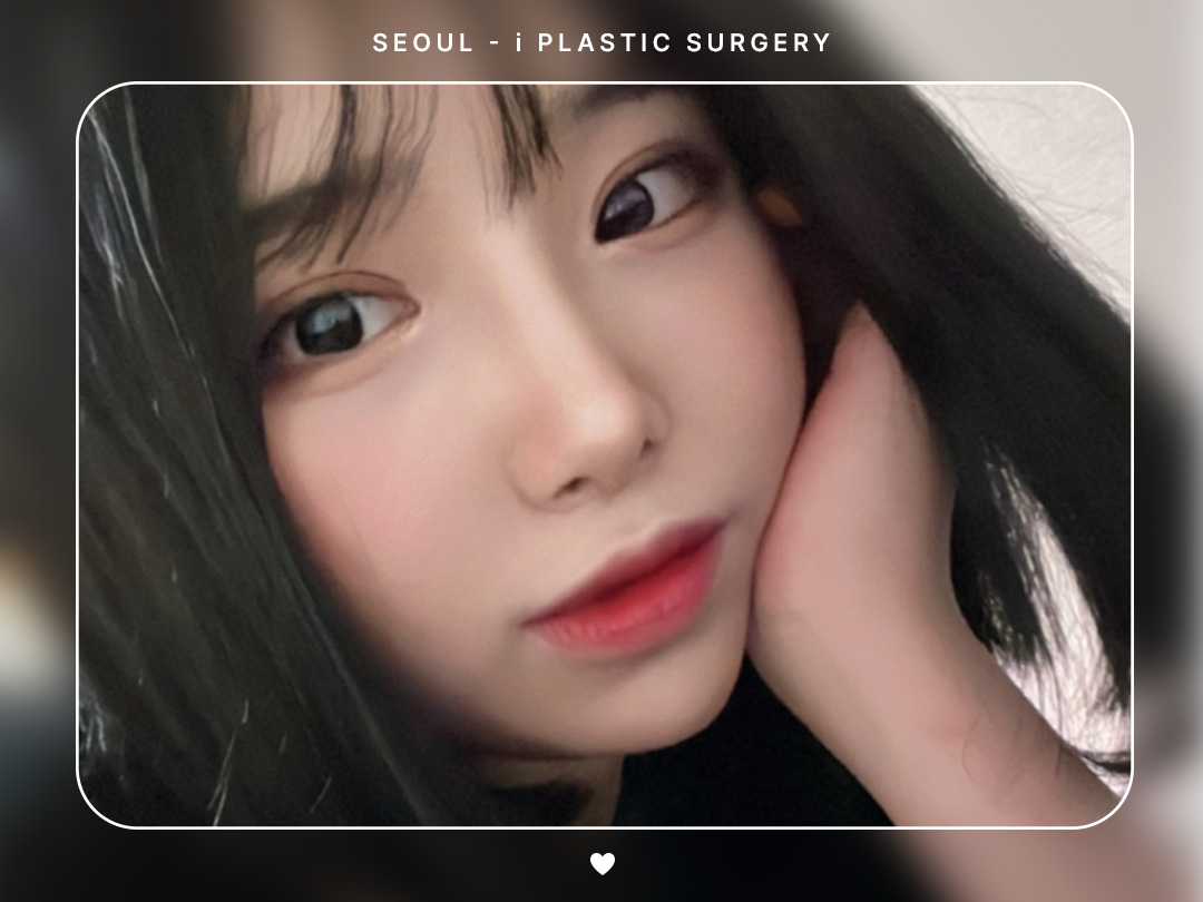 #자연유착 #앞트임 #뒤밑트임