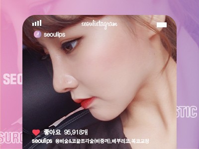 리얼셀카_#융비술&코끝조각술(비중격) #메부리코 #복코교정
