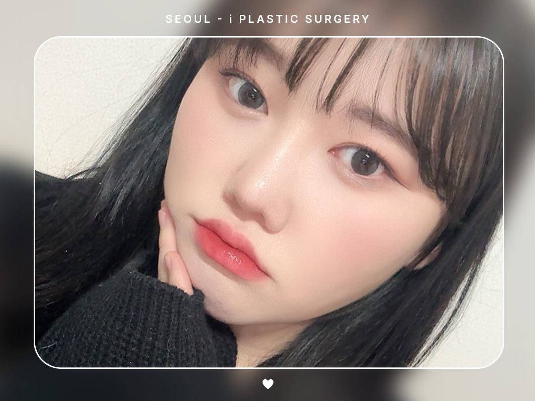 #얼굴지방흡입 #이중턱 #볼