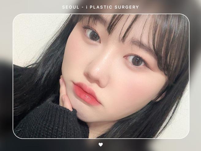 #얼굴지방흡입 #이중턱 #볼