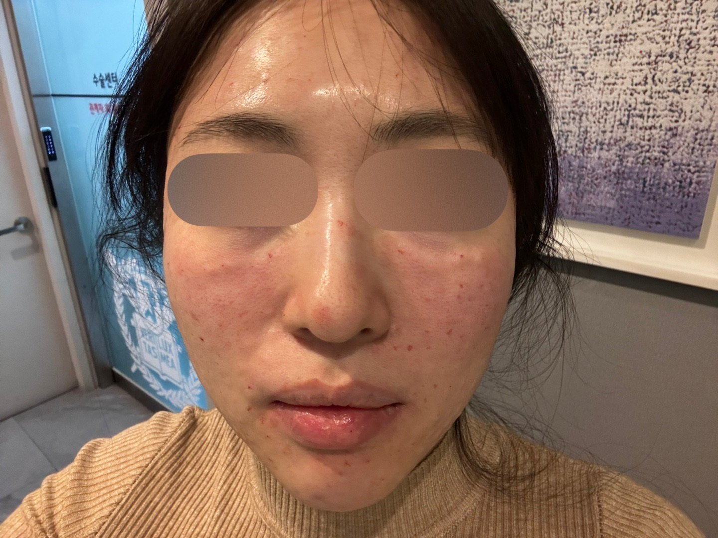 피부결 고민에 받아봤는데 상담부터 친절해서 좋았어요~