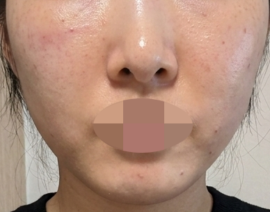 깨끗한 병원에 친절한 응대까지, 자꾸만 다시 가게 되는 곳이에요~