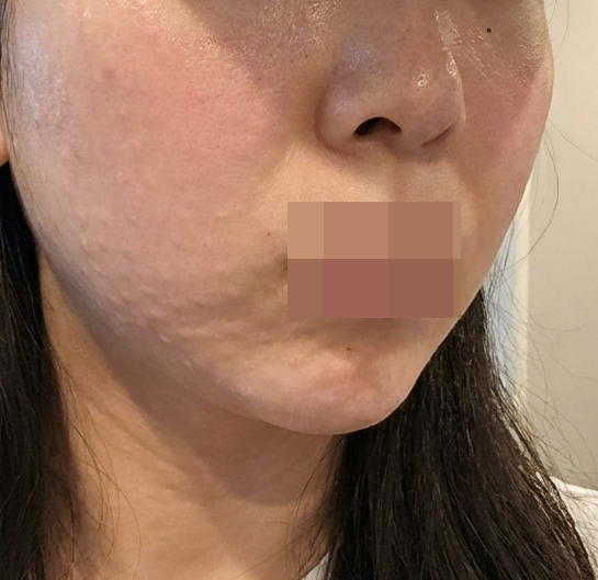 만족스러운 결과 덕에 재방문 확정인 리즈네 후기예요~