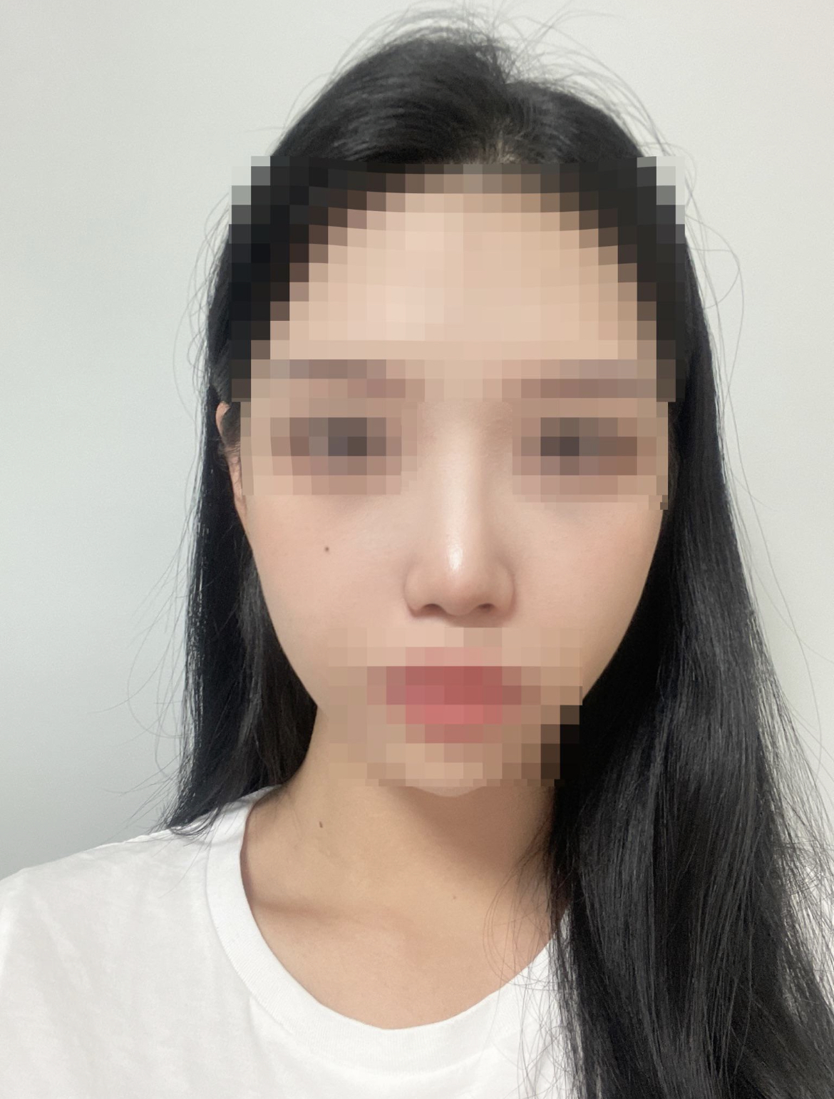미용코 생각하시는 분들이라면 한번쯤 상담 받아보셨음 하네요 !