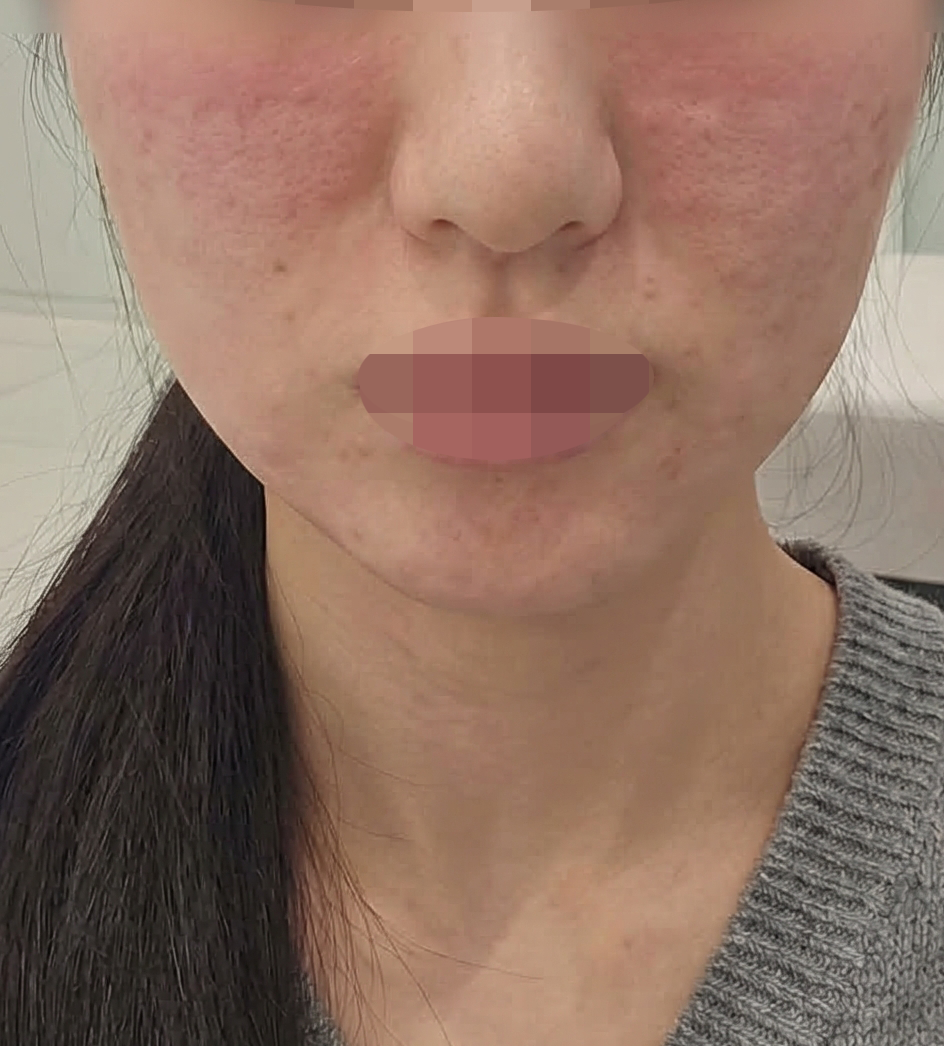 전에도 좋았는데 역시 피부 촉촉해져서 계속 다니는 것 같아요~