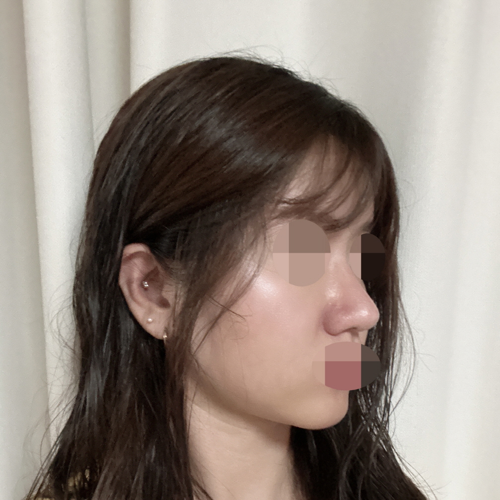 수술 한번으로 자신감을 찾게 되었어요