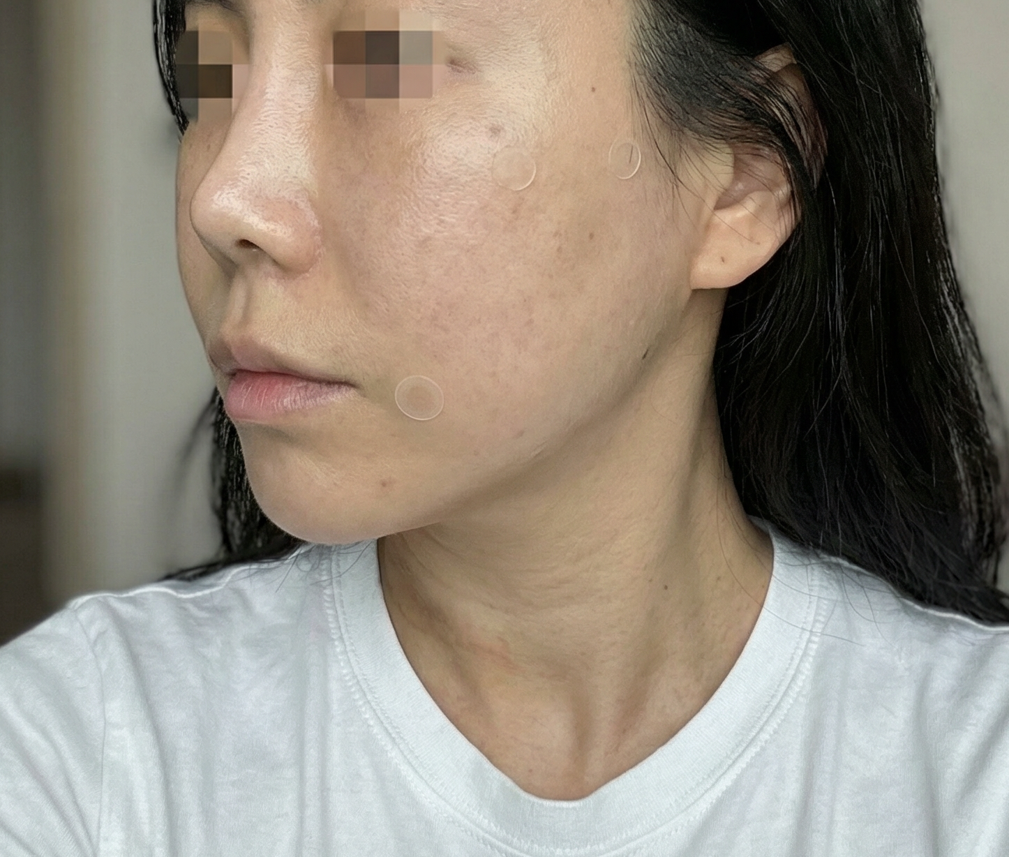 집 앞 병원에서 친절 상담 받고 이중턱 정리했어요~