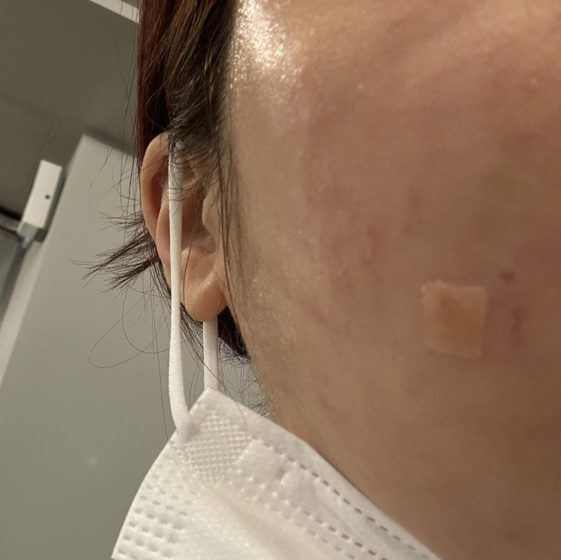 대기 없고 편안한 분위기에 시술까지 꼼꼼하게 해주세요!!