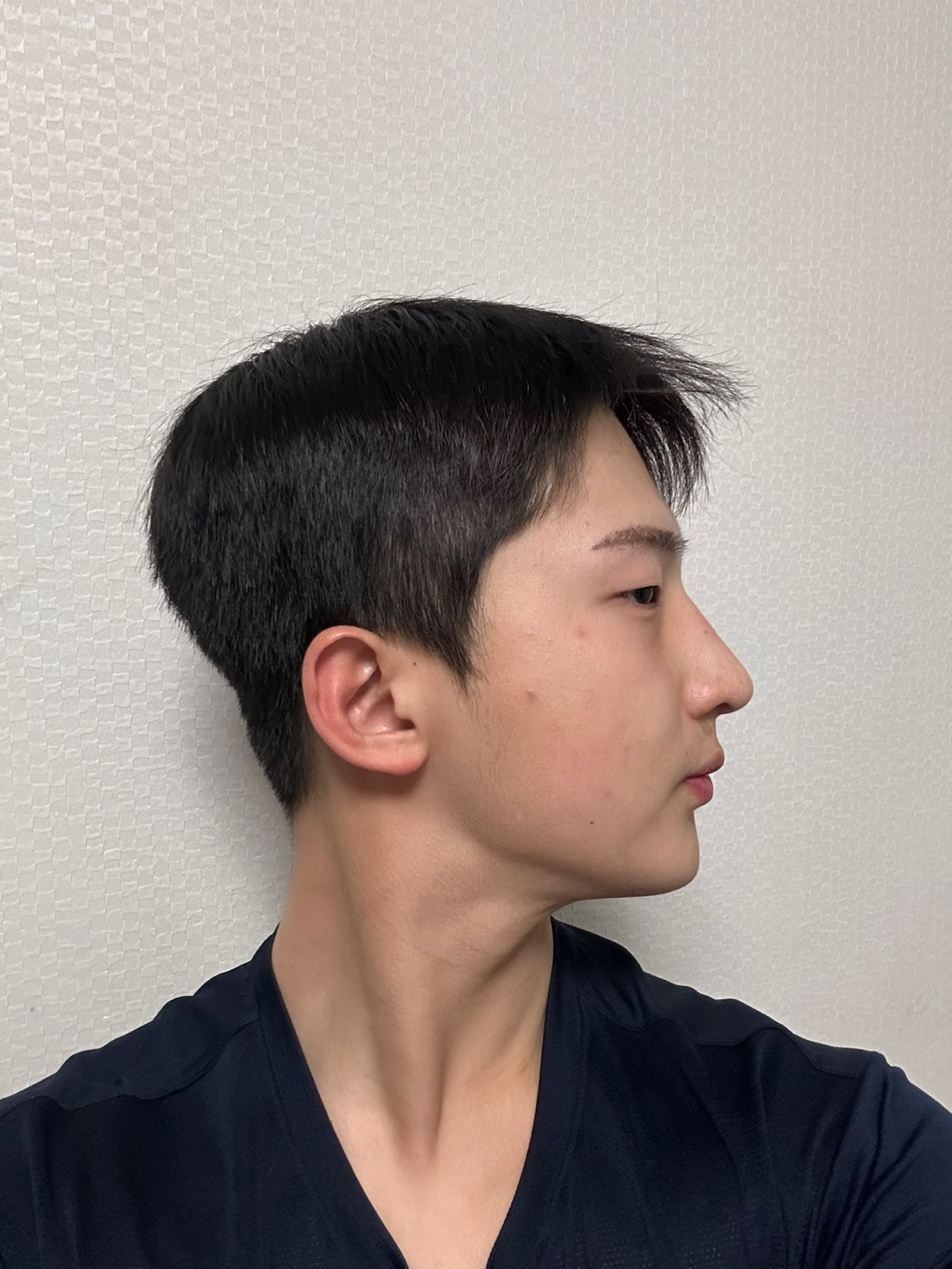 현재는 아무 불편 없이 운동을 즐길 정도로 편해졌습니다!