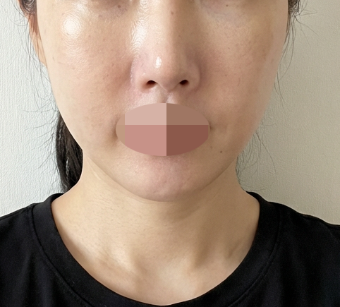 모공 사이사이 메이크업 뜨는 거 진짜 스트레스로 방문했습니다~