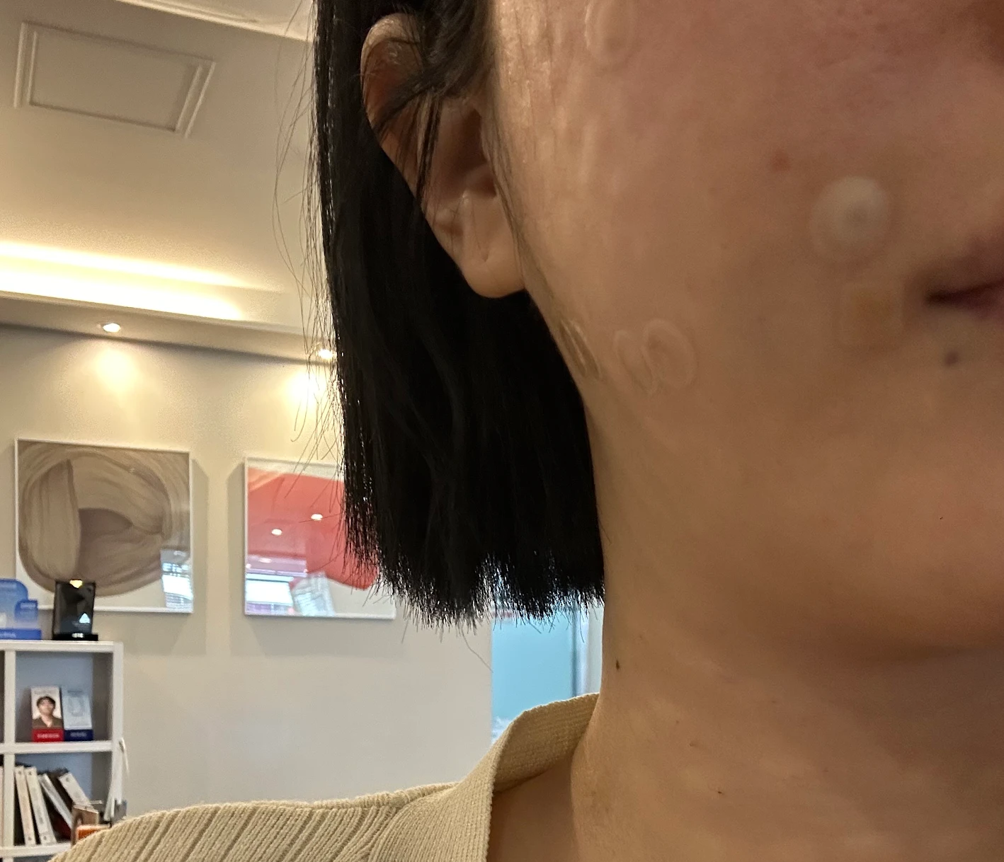 n년째 스킨부스터는 무조건 여기! 단골 정착한 후기예요~